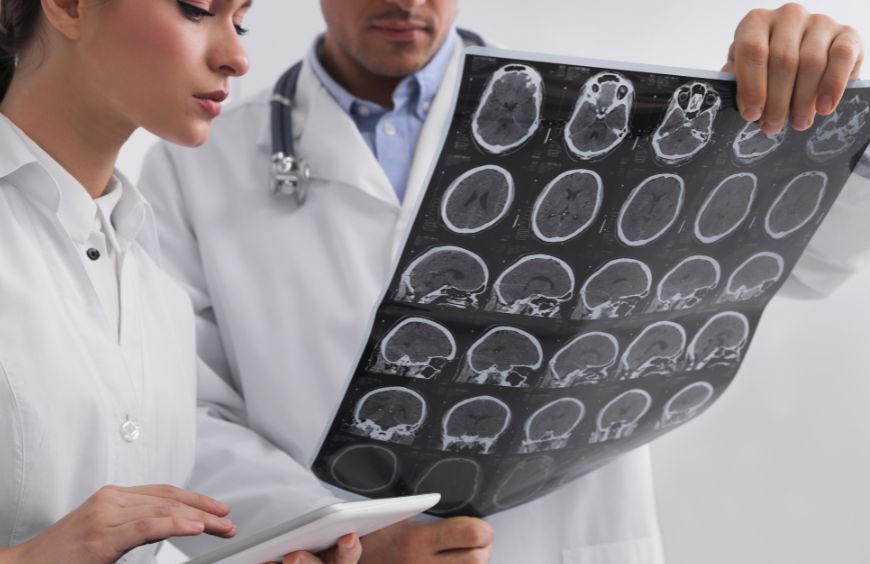 Sclérose en plaques et CBD