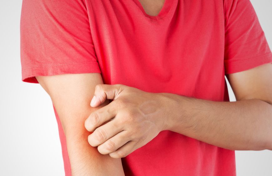 Quel CBD contre les démangeaisons ?  