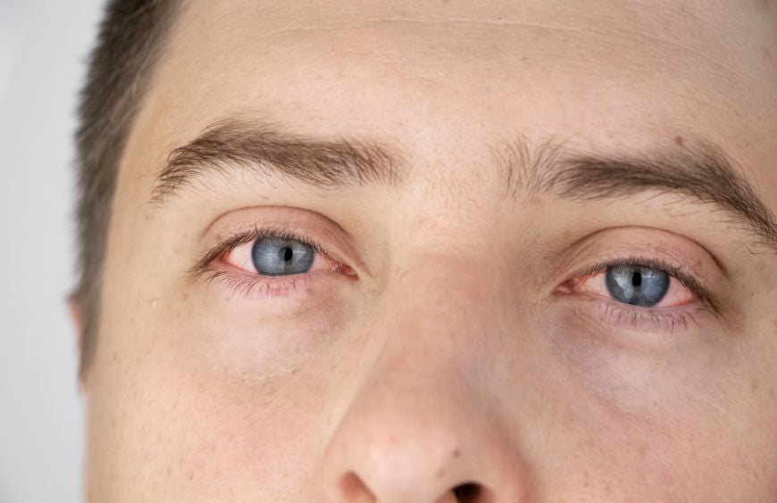 A-t-on les yeux rouges avec du CBD ?